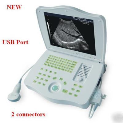 Digital laptop ultrasound machine+convex&transvaginal