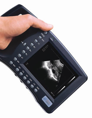 Portable battery palm size medical ultrasound scanner
