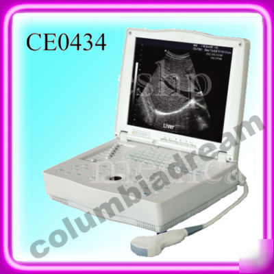 Ultrasound machine with convex probe(2.5-3.5-5.0MHZ) 