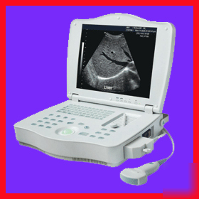 New full-dig portable ultrasound scanner system machine