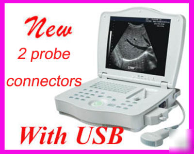 Full digital laptop ultrasound scanner/system 2 probes