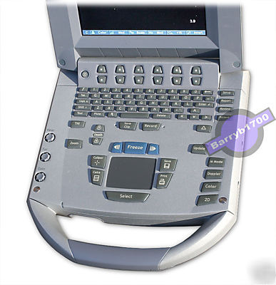Sonosite titan portable ultrasound system - amazing 