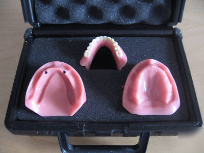 Dental typodont implant patient education model kit