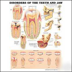 Disorders of the teeth and jaw anatomical chart/model