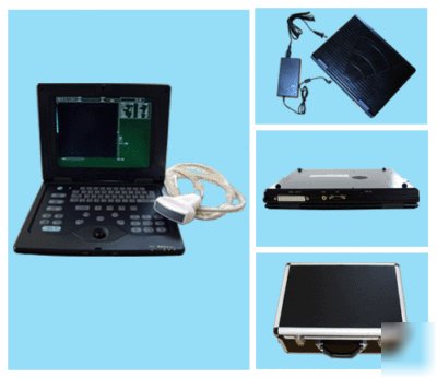 Digital laptop ultrasound scanner, convex / linear, uss