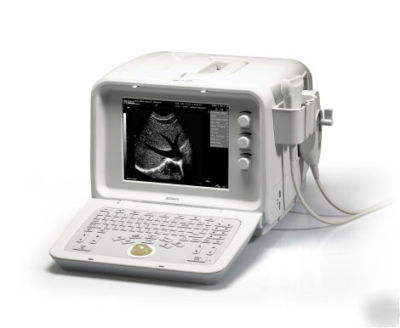 Edan ultrasound scanner dus 3 ob - gyn - vascular