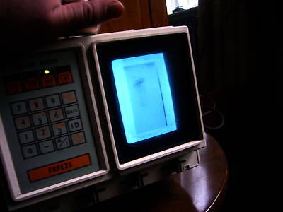 Shimadzu sdl-32. portable ultrasound