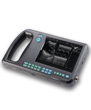 New 1.3KG light ultrasound scanner b-ultrasound machine 