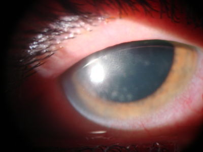 Ophthalmic video system