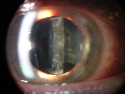 Ophthalmic video system